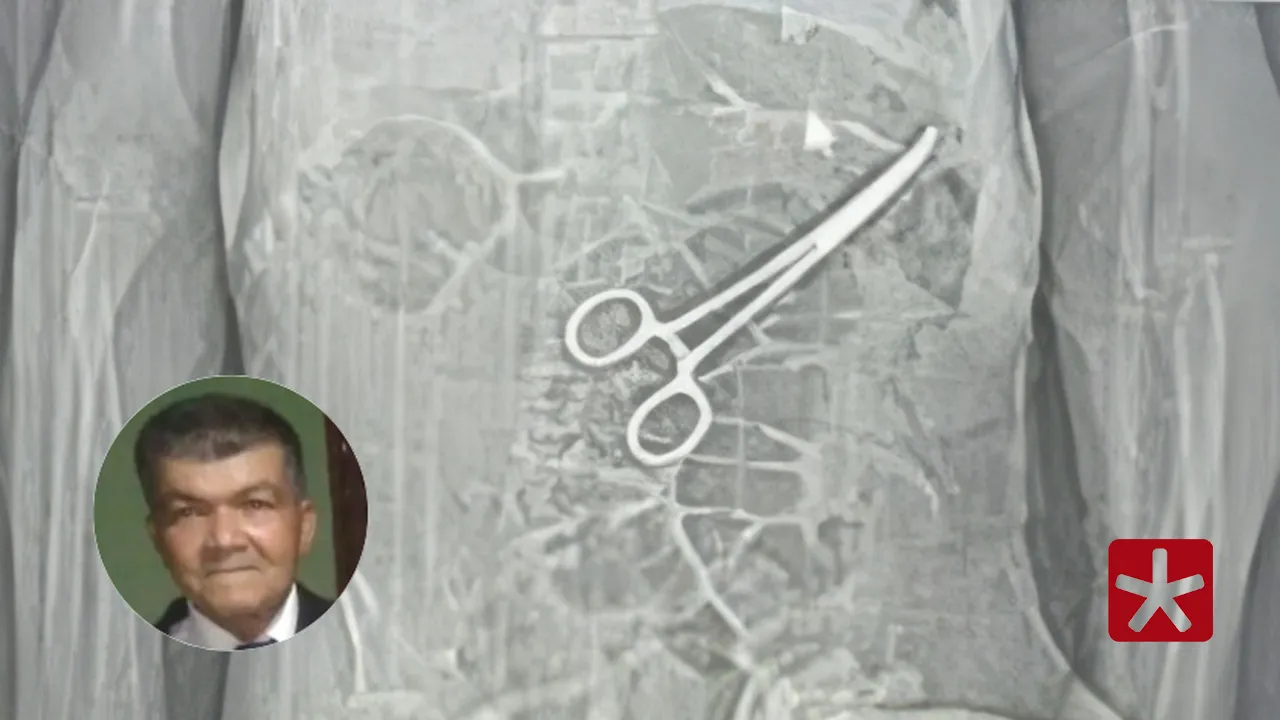 Corpo de idoso é exumado para investigar causa da morte após pinça esquecida no abdômen 