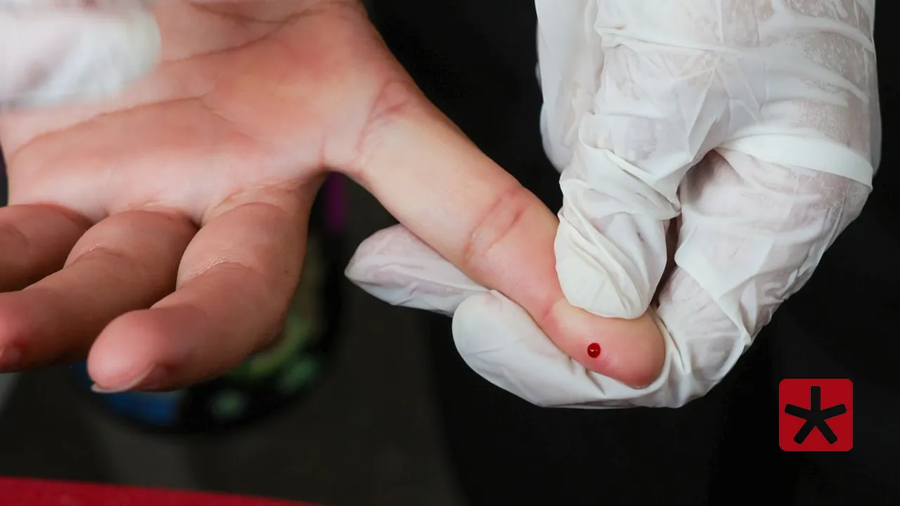 Teste rápido de dengue pode ser feito em postos de saúde e hospitais públicos