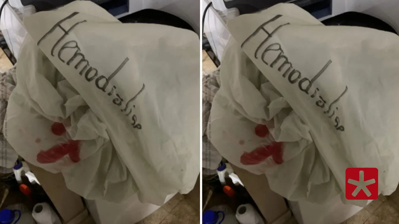 Corregedoria-Geral de São Gotardo encaminha denúncia após caso de lençóis com sangue em hemodiálise